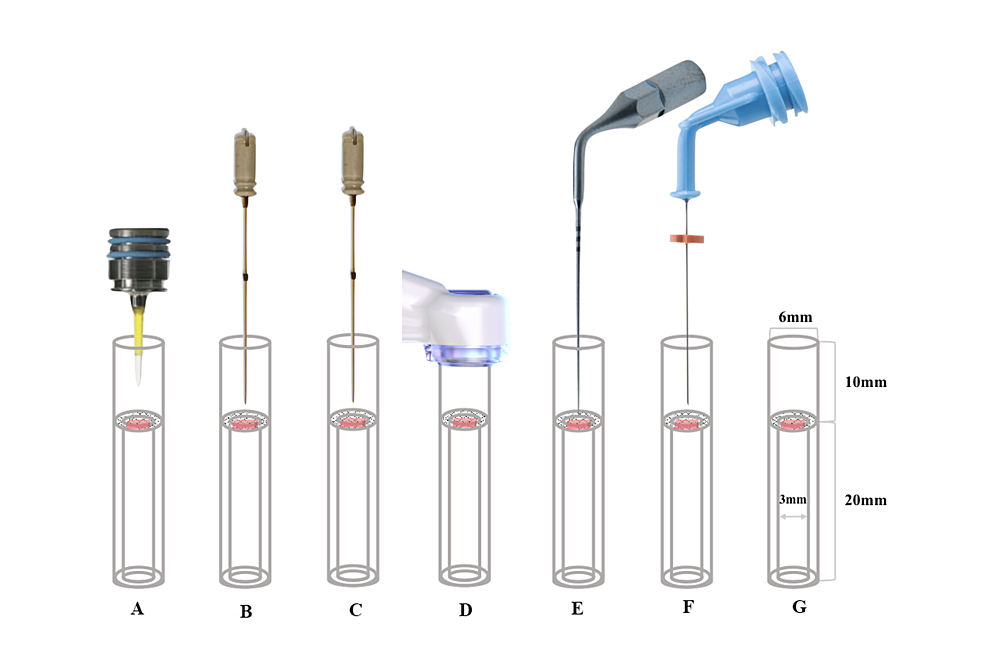 Effectiveness of Six Irrigation Techniques With Sodium Hypochlorite in Tissue Di